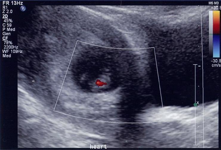 Dating ultrasound alberta