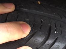 Nail removed
