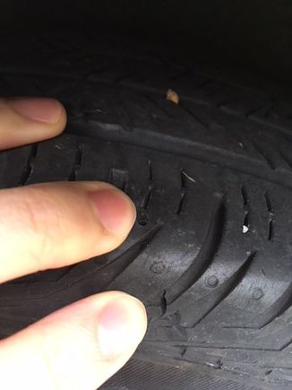 Nail removed