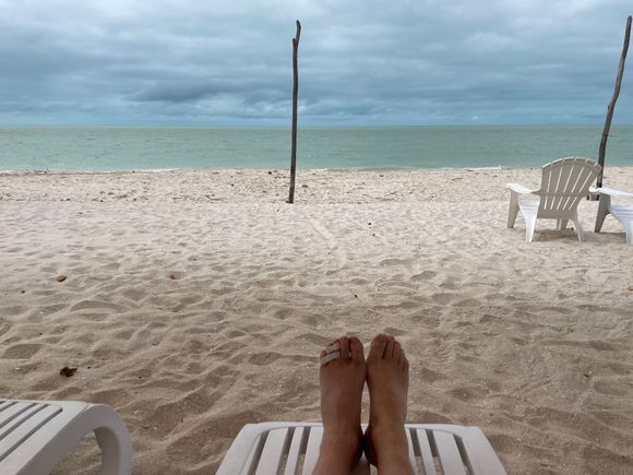 My feet with bandage on broken toe