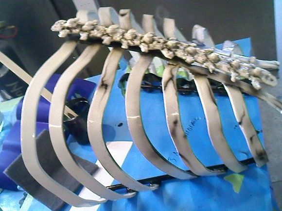 ribs/spine side view