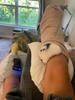 Josie's Foot Surgery