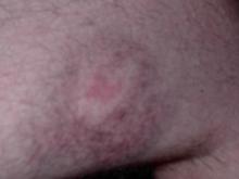 Paintball Medal1.jpg