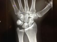 xray1