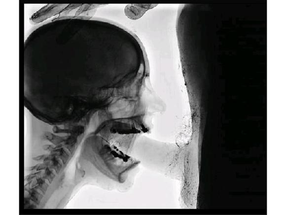 Radiology Students...