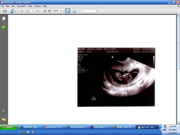 11wks.JPG